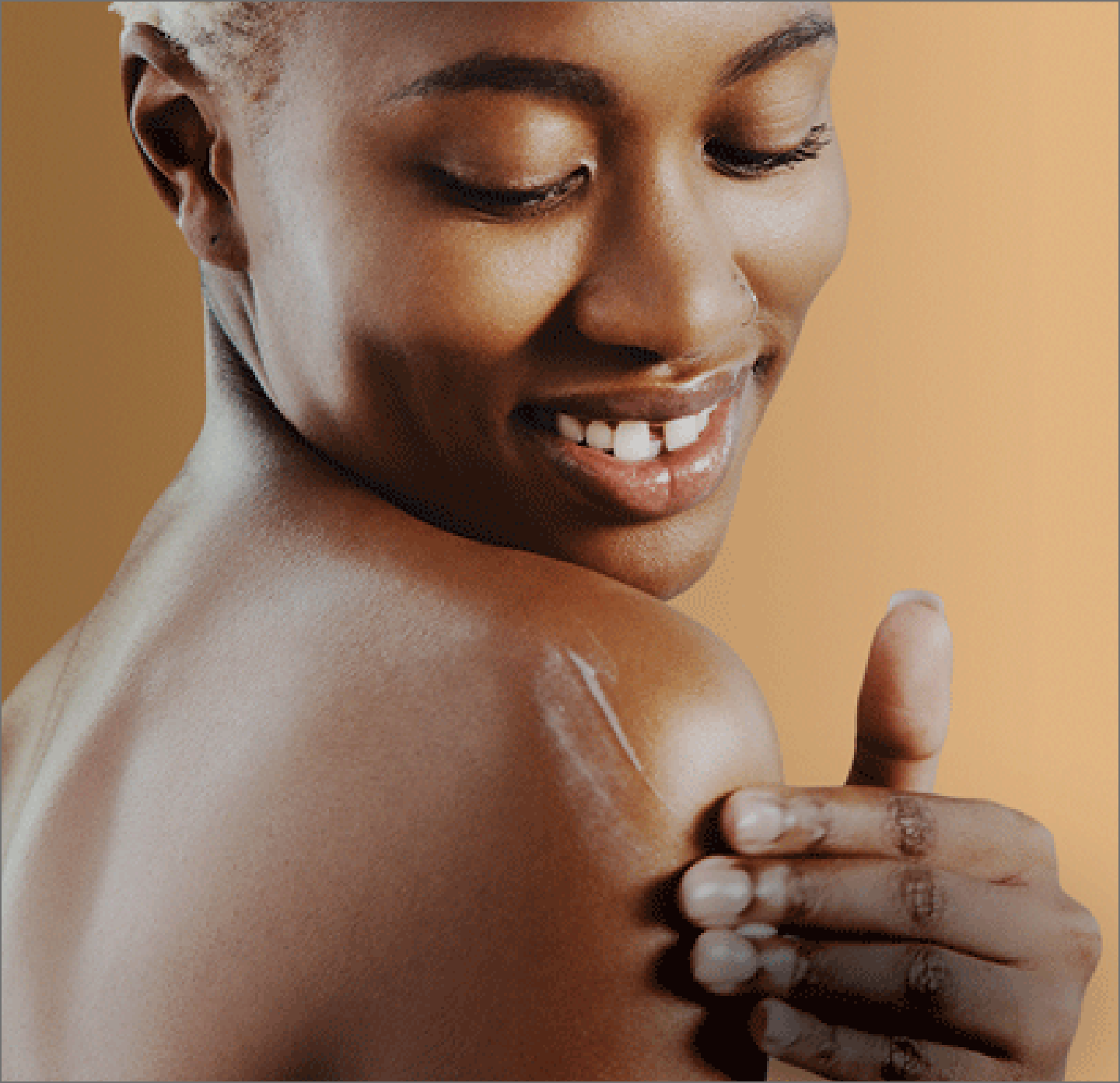 Woman applying lotion to uneven skin tone
